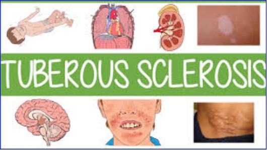 TSC Alliance Endowment Fund Invests