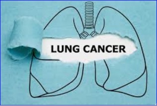 Nuvalent reveals preclinical data on cancer drug zidesamtinib