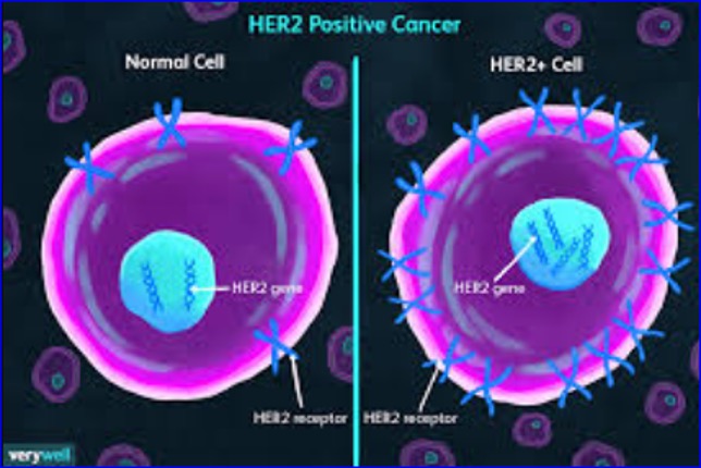 Avutometinib Combo Shows Activity, Safety for HR+/HER2- Breast Cancer