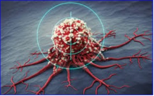 Windtree Receives Offer for Its Preclinical Oncology Drug Candidate