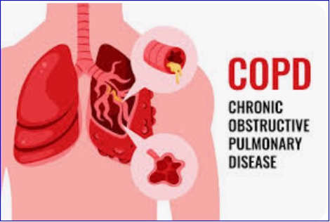 Merck spends $10 billion for Verona, gaining access to its COPD medication