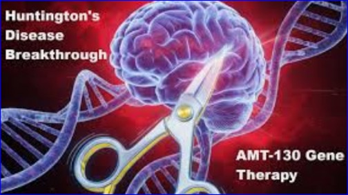 uniQure Staggers as FDA Questions Data for Huntington’s Gene Therapy Candidate