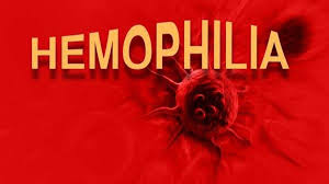 Freeline's One Dose Gene Therapy could Transform Hemophilia B Treatment