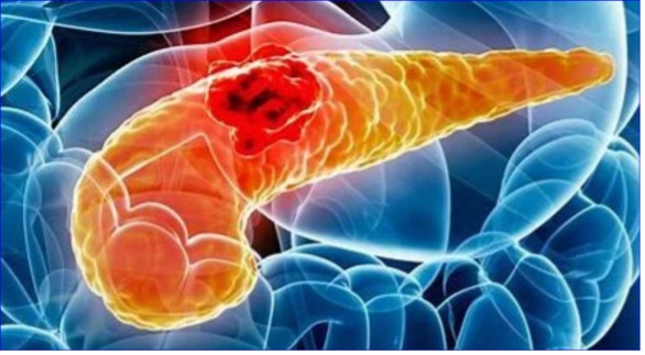 CDE grants Breakthrough