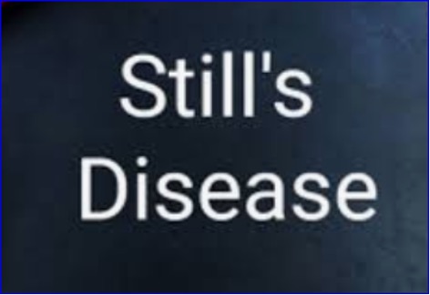 FDA approves Gamifant for macrophage activation syndrome in Still’s disease