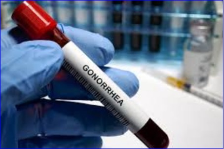 First gonorrhoea antibiotics in decades herald new era of treatment