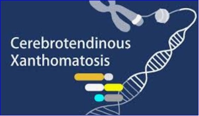 FDA Approves First Treatment for Cerebrotendinous Xanthomatosis, a Rare Lipid Storage Disease