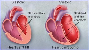AskBio’s AB-1002 gene therapy receives FDA Fast-Track status