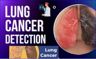 Blood-Based Screening Test