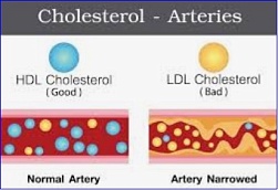 Editas Medicine reports 90% LDL-C reduction in preclinical studies