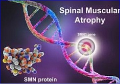 Preclinical study finds antidepressant may boost SMN