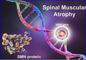 Preclinical study finds antidepressant may boost SMN