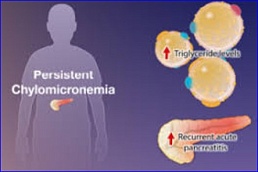 Mammoth Biosciences to Present Preclinical Data on MB-111
