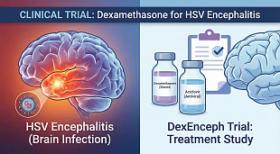 Clinical Trial: Dexamethasone Safe in Encephalitis, Early Use May Help