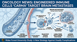 Engineered Immune Cells (CARMA) Show Promise Against Brain Metastases