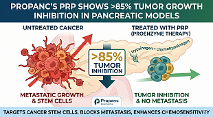 Propanc's PRP Shows >85% Tumor Growth Inhibition in Pancreatic Cancer