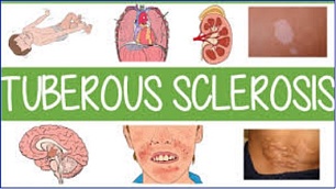 TSC Alliance Endowment Fund Invests