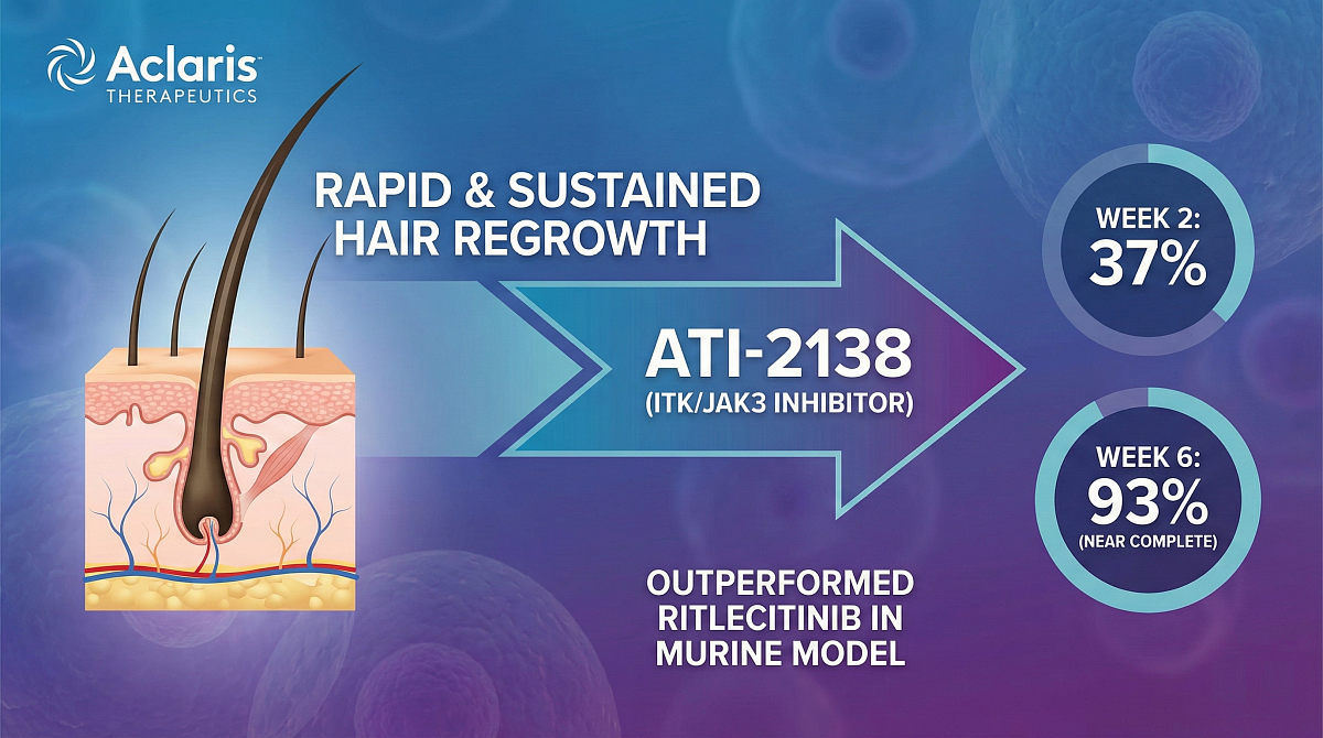 Aclaris ATI-2138 Shows Rapid Hair Regrowth in Alopecia Areata Model