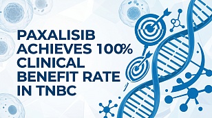 Kazia Therapeutics Paxalisib Achieves 100% Clinical Benefit Rate in TNBC
