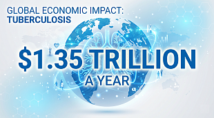 Global Economic Impact: Tuberculosis Costs the World $1.35 Trillion a Year