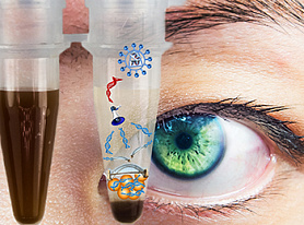Decentralised trials gaining ground in oncology, says report