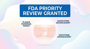 FDA Grants Priority Review to Takeda's Zasocitinib for Plaque Psoriasis
