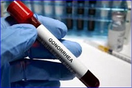 First gonorrhoea antibiotics in decades herald new era of treatment