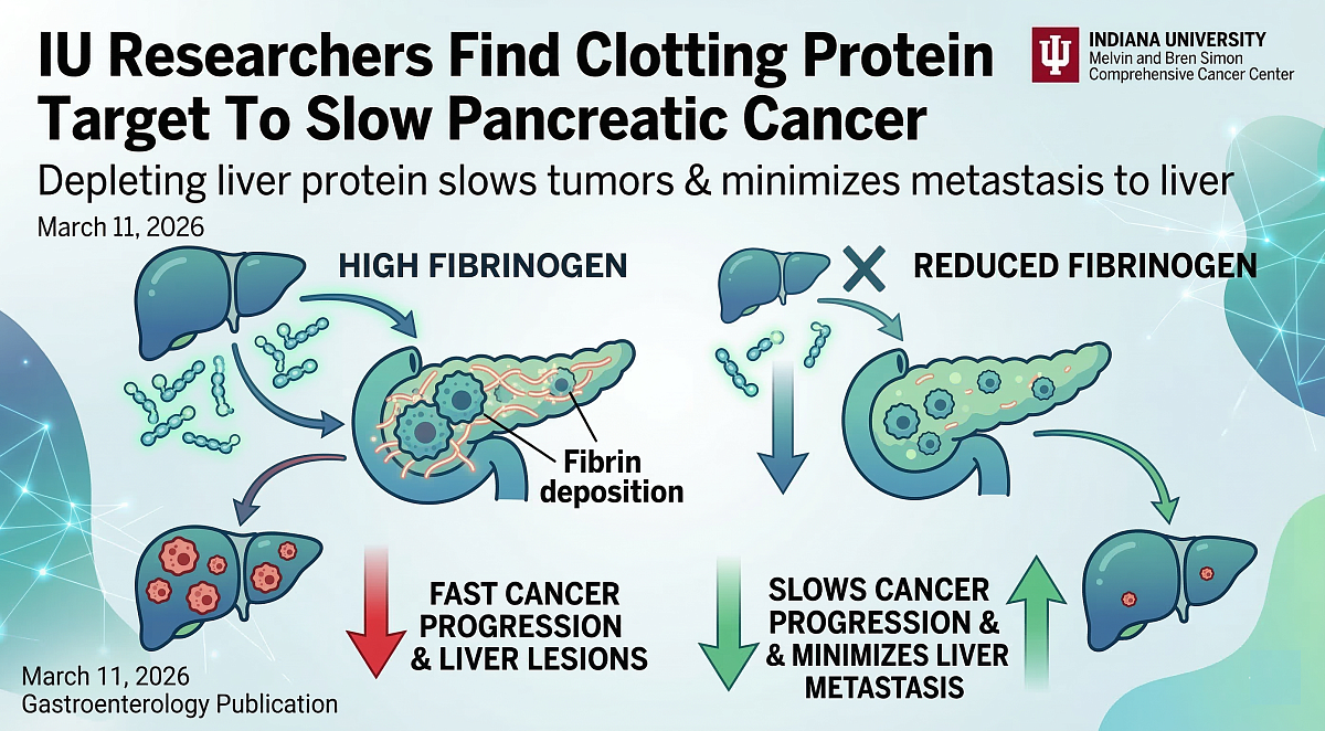 IU Researchers Identify Clotting Protein as Target in Pancreatic Cancer