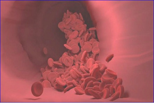 Clopidogrel
