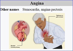 Alembic Pharma gets US FDA