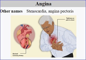 Alembic Pharma gets US FDA