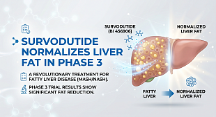 Survodutide Fatty Liver Disease Treatment Normalizes Liver Fat in Phase 3
