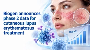Biogen announces phase 2 data for cutaneous lupus erythematosus treatment