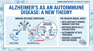 Alzheimer’s Disease May Be an Autoimmune Condition, New Theory Suggests